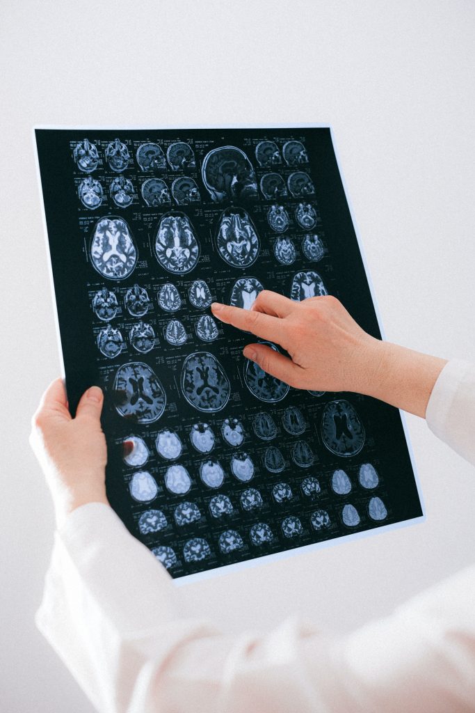 a-medical-description-of-cerebral-palsy